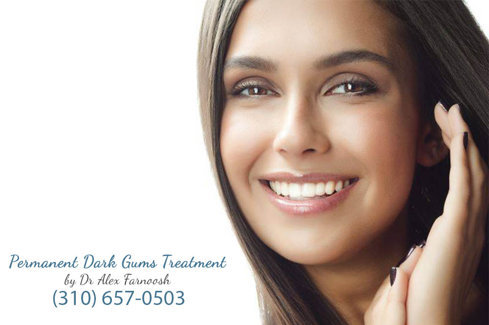 Should You Worry about Having Dark Gums?
