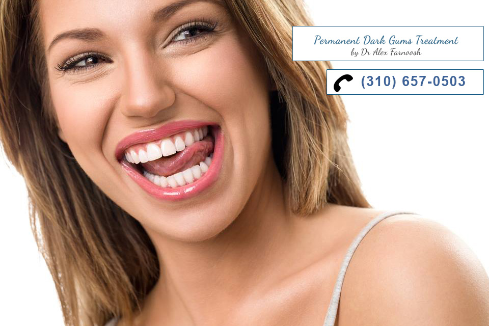 Beverly Hills Cosmetic Dentist